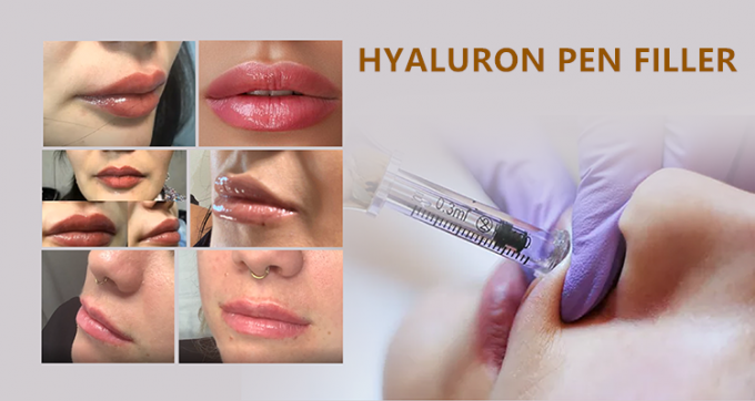 ペンおよびマイクロ針の処置2のためのhyaluronic酸の注入口の唇の注入口のhyaluronic酸の注入