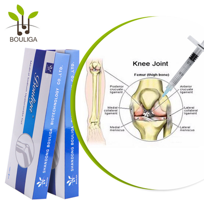 骨関節炎のための非外科ヒアルロン酸酸の膝の注入1mlの処置