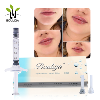 Bouligaの商標のHyaluronの唇のための酸の血清の手頃な価格2mlのHyaluronic酸の皮膚注入口