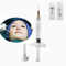 操り人形ラインのための韓国の唇1mlのHyaluronic酸の皮膚注入口